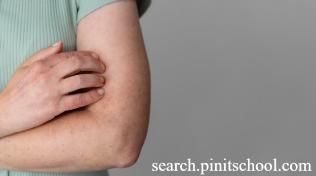 Ciri-ciri Penyakit Ginjal yang Terlihat di Kulit